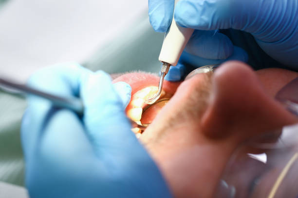 Best Emergency Orthodontic Repairs in Henderson, TX