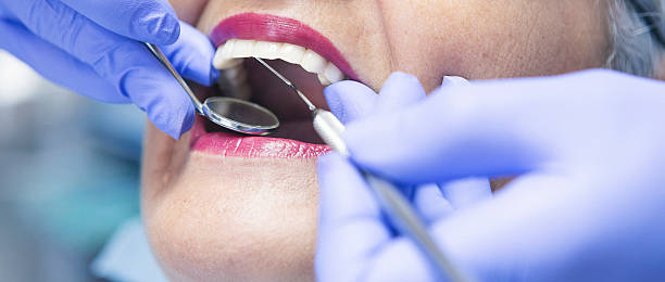 Best Emergency Treatment for Toothache in Henderson, TX